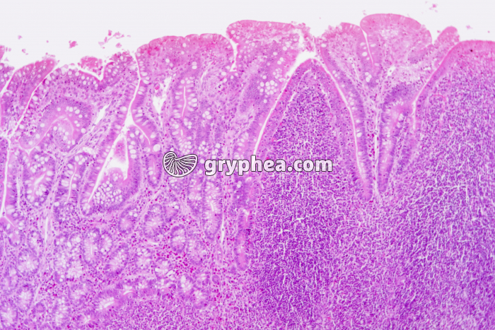 Plaque de Peyer x25 - gryphea.org